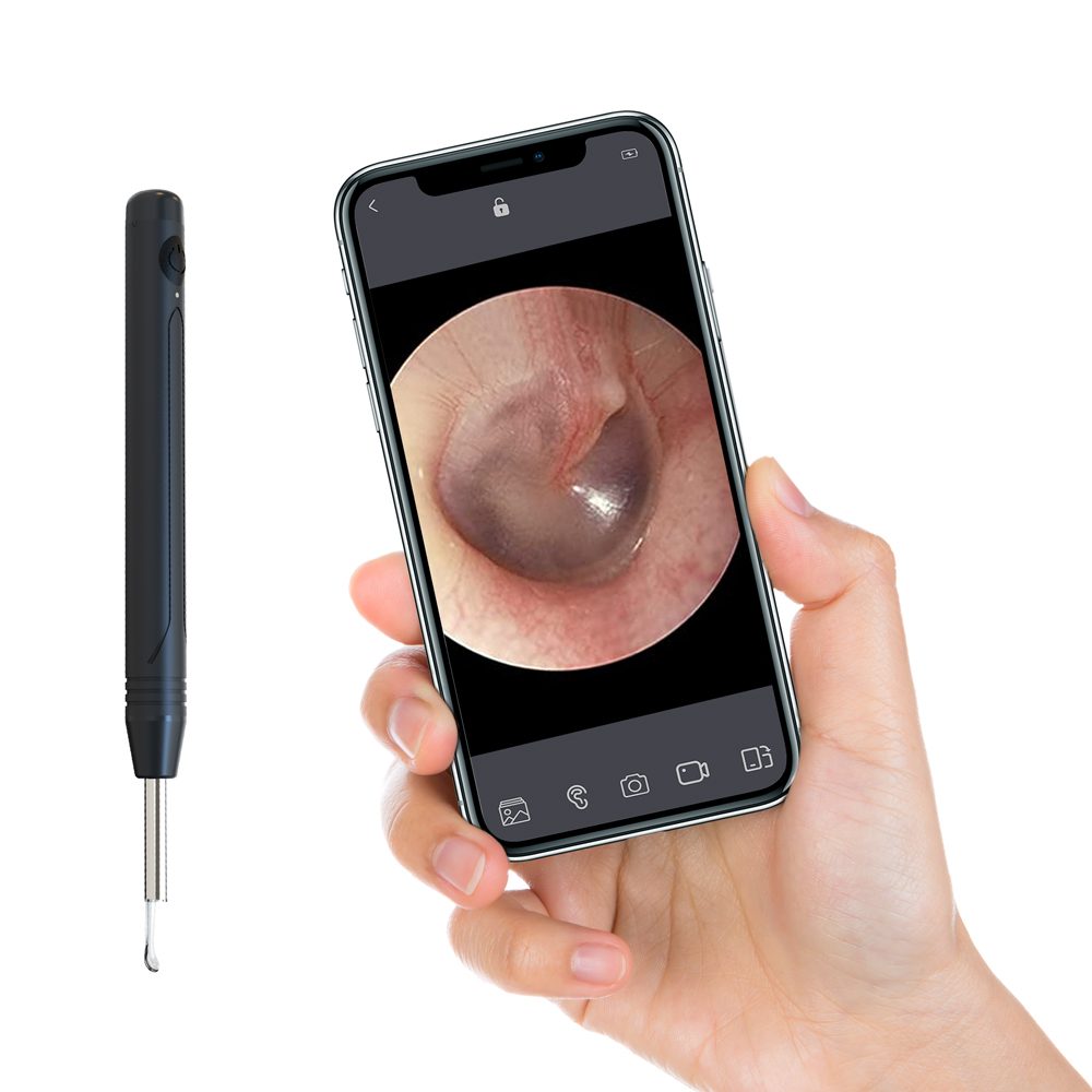 Wireless Ear Wax Remover Camera WIFI 1080P LED Endoscope Spoon Cleaning Otoscope
