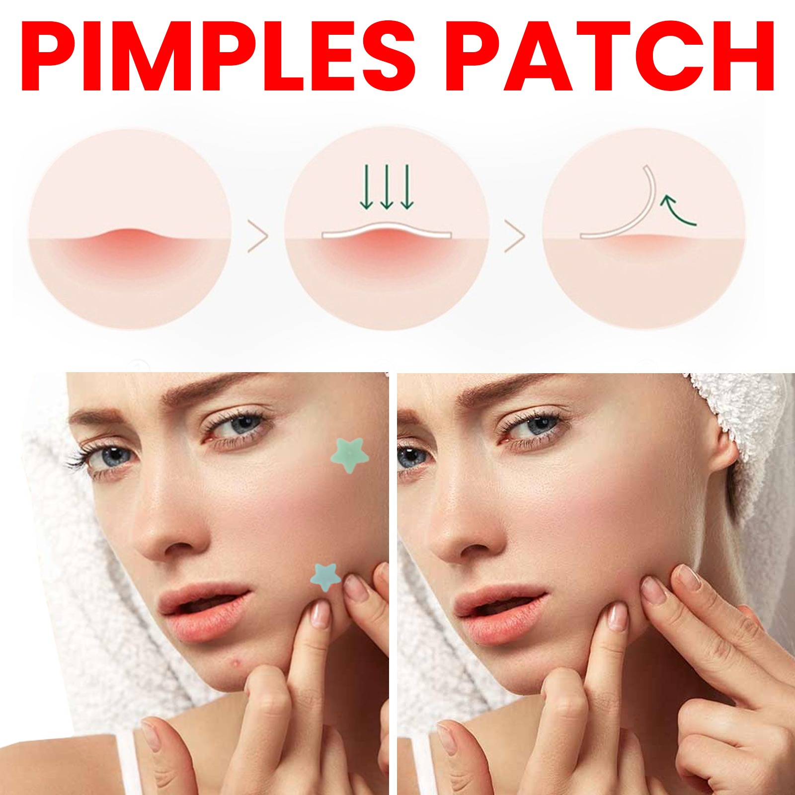 Repair Acne Patch,200patches