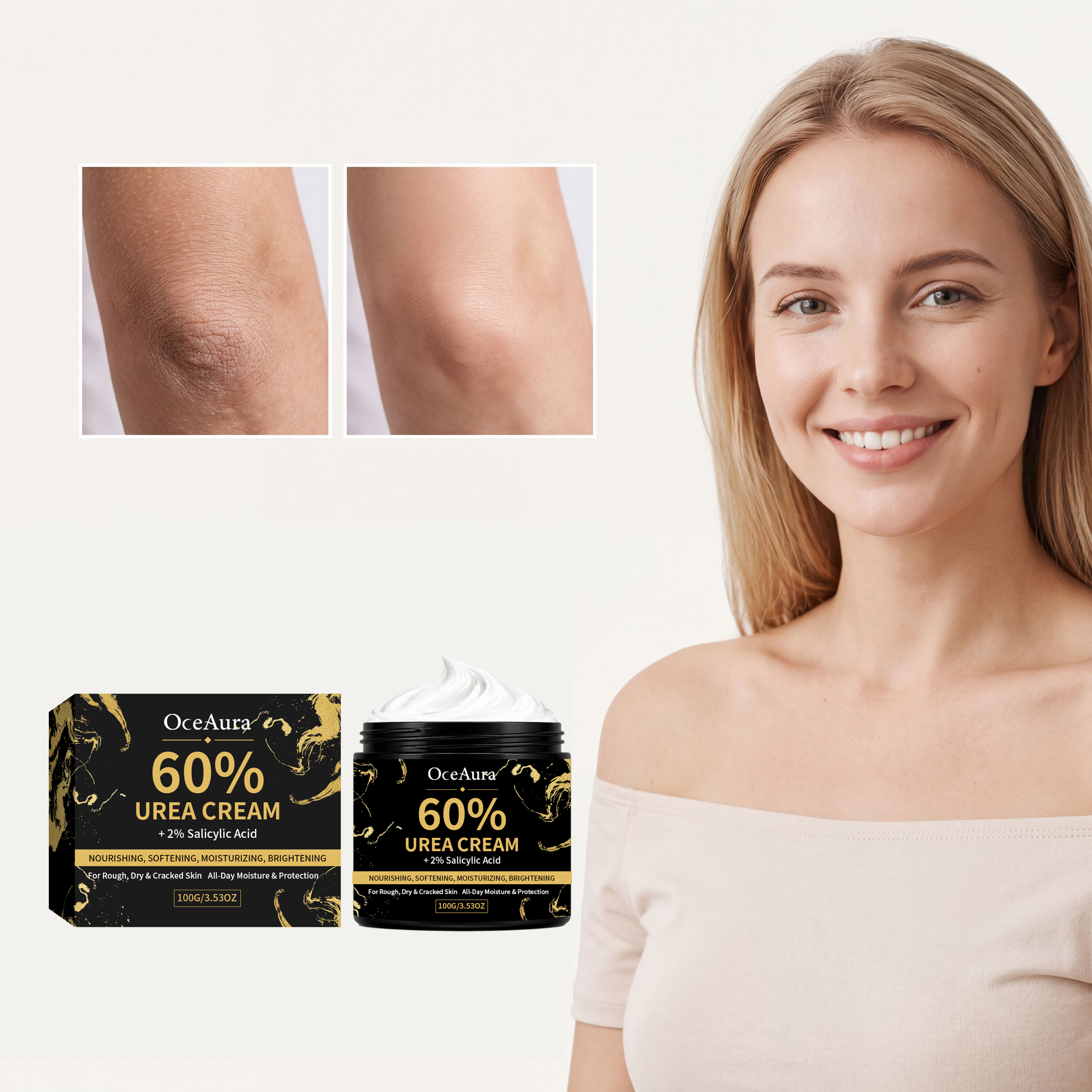 Urea Moisturizing Cream — foto 8