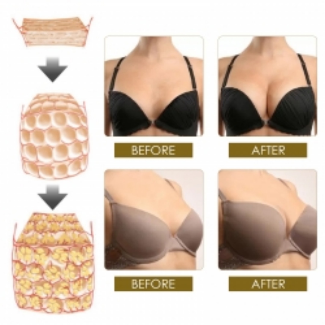 South Moon Breast Enhancement Patch, Plump Chest Massage Patch For Firming And Moisturizing Breasts