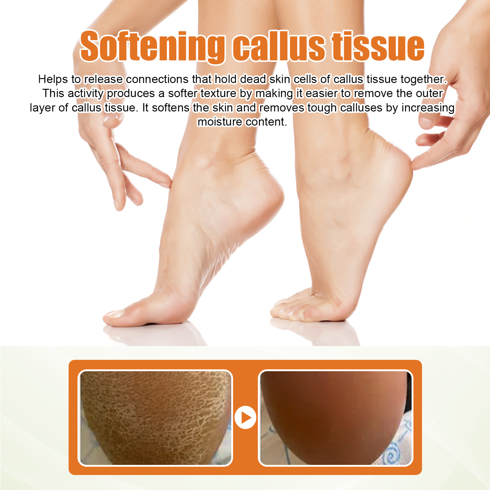 Title 5, Foot Exfoliating Spray Mild Callose Remove Dead...