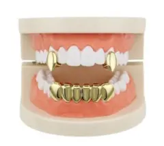 Vampire Grills - Gold - View 1