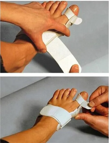 Hallux Valgus Corrector With Foot Valgus Separator – image 6