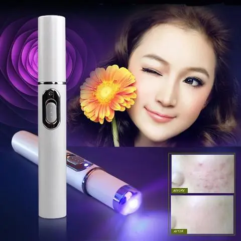 Blue Light Therapy Acne Laser Pen Soft Scar Wrinkle Removal Treatment Device Skin Care Beauty Equipment – image 6