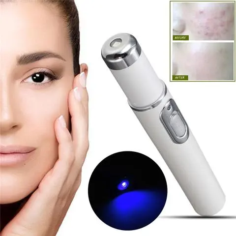 Blue Light Therapy Acne Laser Pen Soft Scar Wrinkle Removal Treatment Device Skin Care Beauty Equipment – image 2