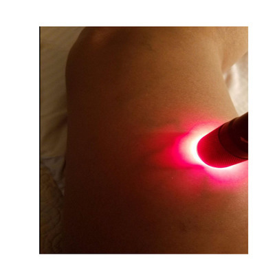 Smart Vein Locator