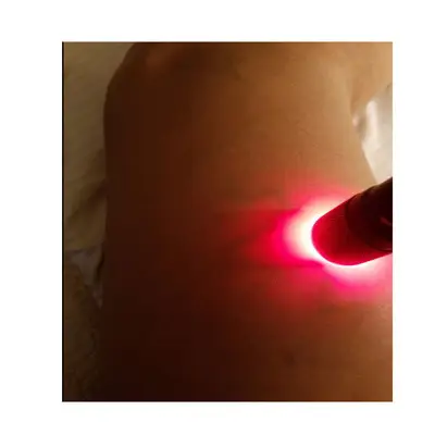 Smart Vein Locator