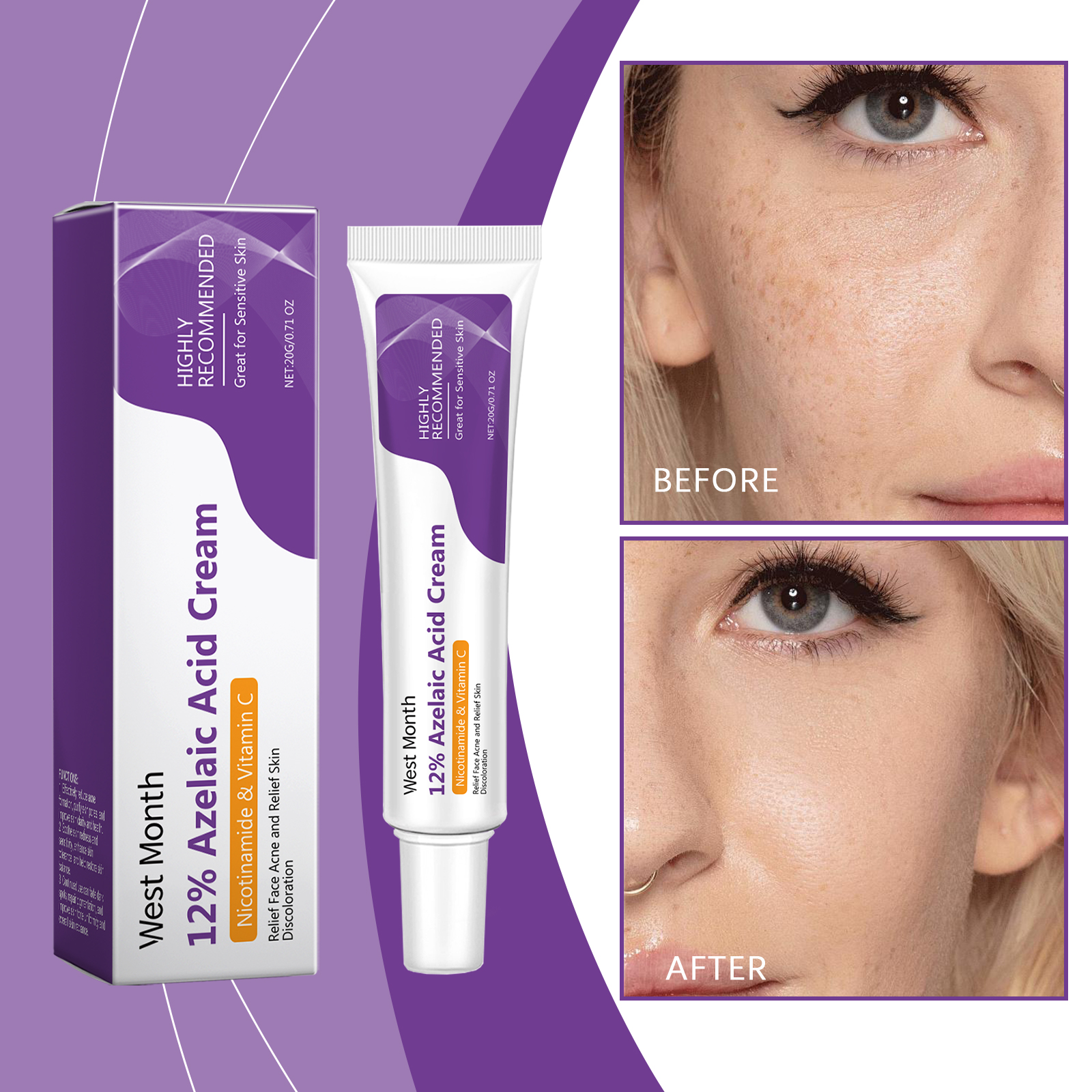 Azelaic Acid Repair Face Cream 20g 1 Box — foto 6