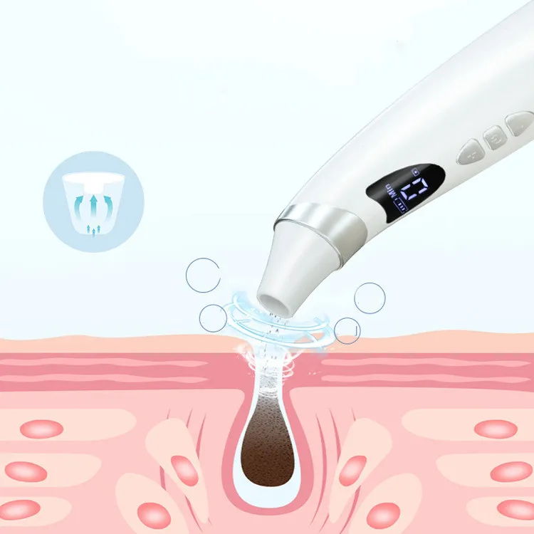 Electric Visual Blackhead Suction Instrument Household Cleansing Pore Cleaner For Skin Equipment Skin Care Tool – image 3