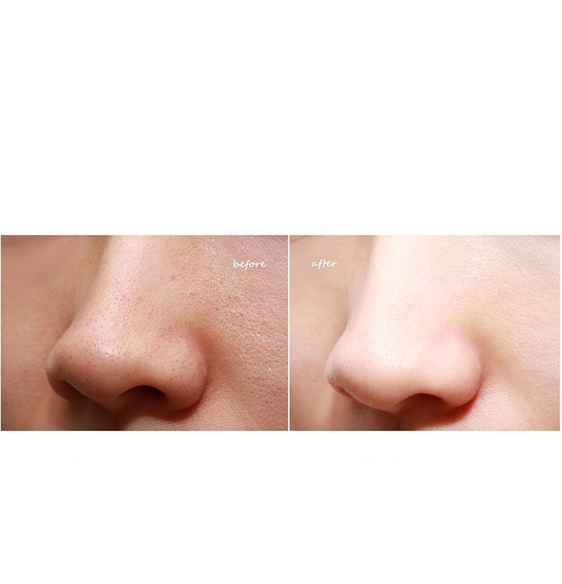 Electric Facial Cleansing Beauty Instrument