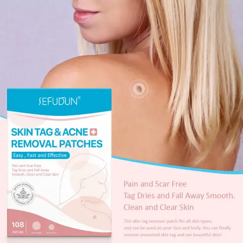 Acne Skin Tag Remover Beauty Patch Wart Removal Stickers