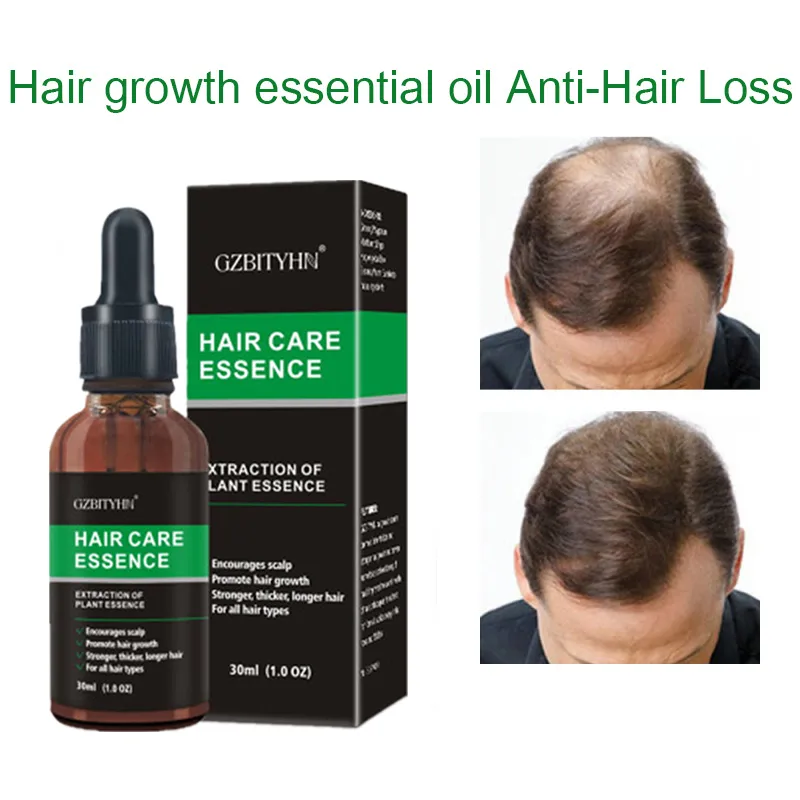 Hair Growth Oil Oil Oem Care Essential Oil
