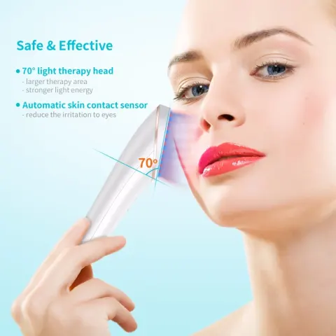 Acne Light Therapy Xpreen Wireless Rechargeable Treatment Device Clearing