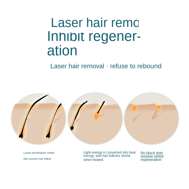 Mini épilateur laser épilatoire à domicile, épilation permanente, système IPL – Image 3