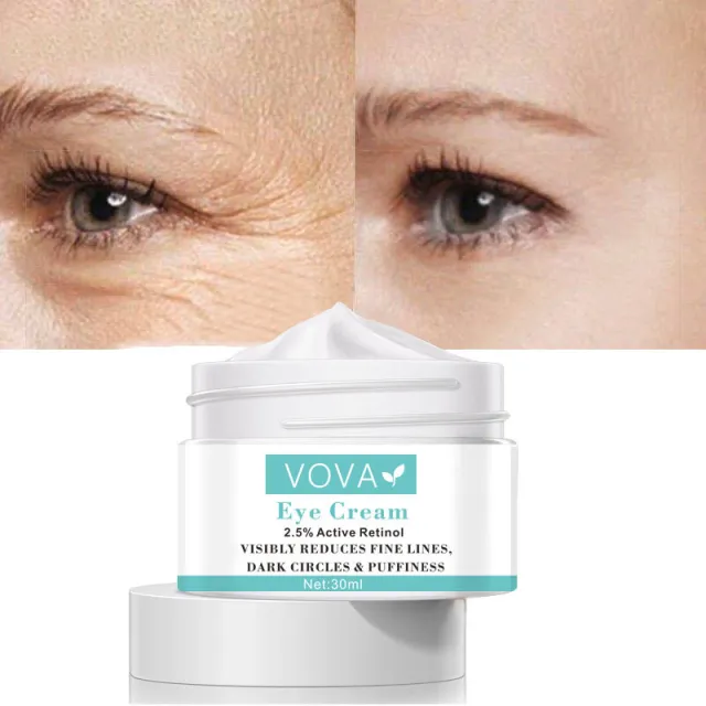 Cross Border Vova Wrinkle Reduction Eye Cream, Fat Particles To Reduce Dark Eyes And Fine Lines, Eye Bags And Eye Cream White - Shop at LoveMi
