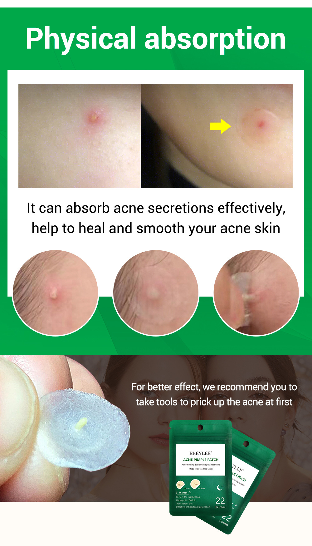 Title 3, Night acne stickers, fade acne marks. Sleep awa...