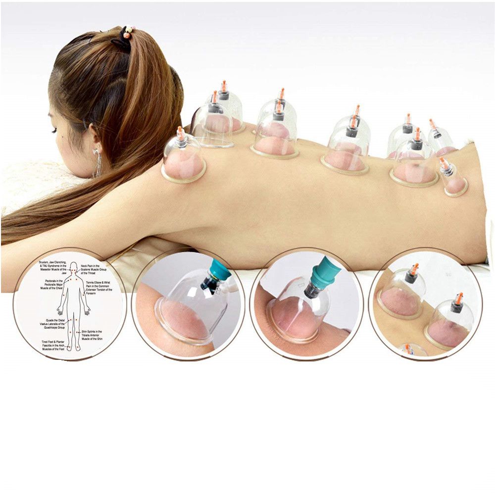 Title 1, Kang Zhuci Cupping Device Relieves Muscle Pain ...