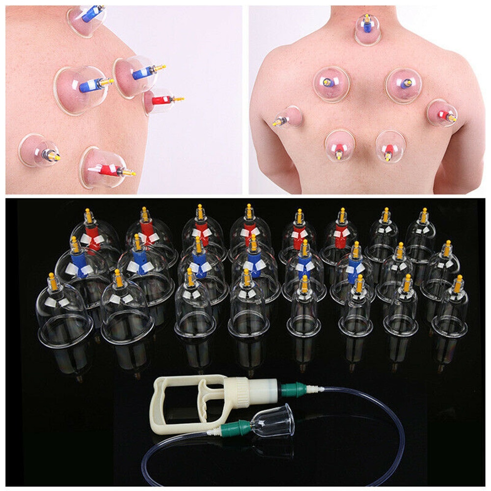 Title 6, Kang Zhuci Cupping Device Relieves Muscle Pain ...