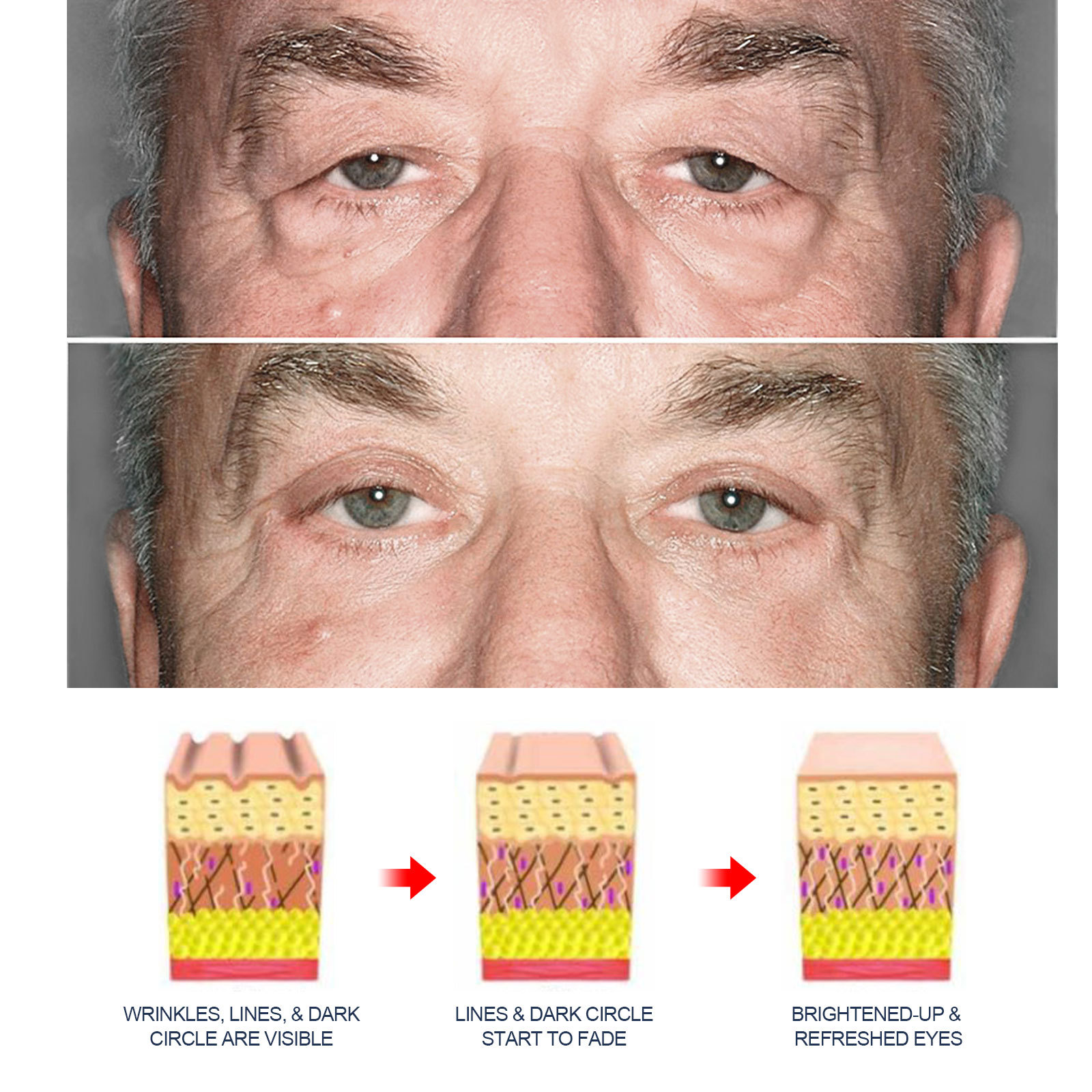 Title 7, Männer Retinol Augencreme Strafft, Helliert Aug...