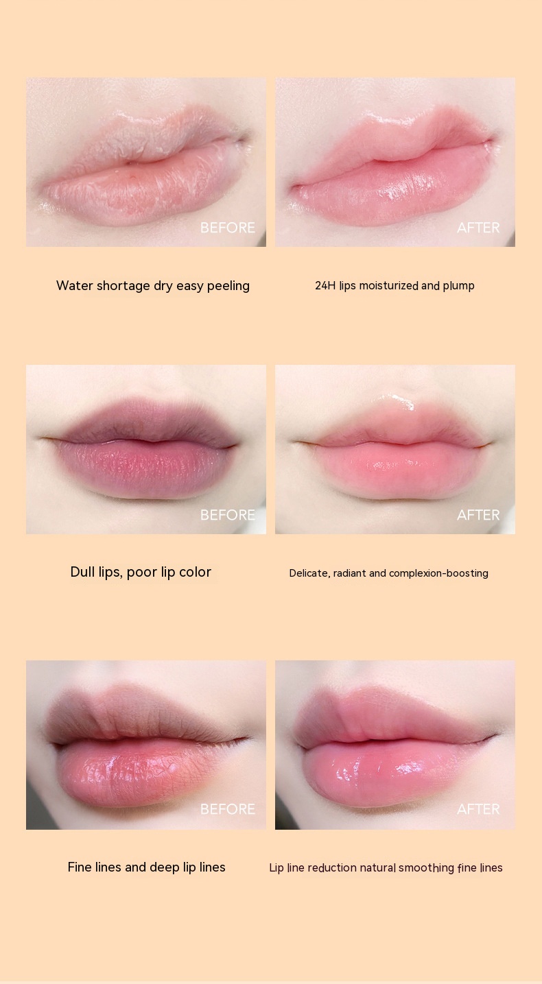 Four Sets Of Lip Masks To Improve Lip Dryness, Peeling, And Fruity Taste - Image 15