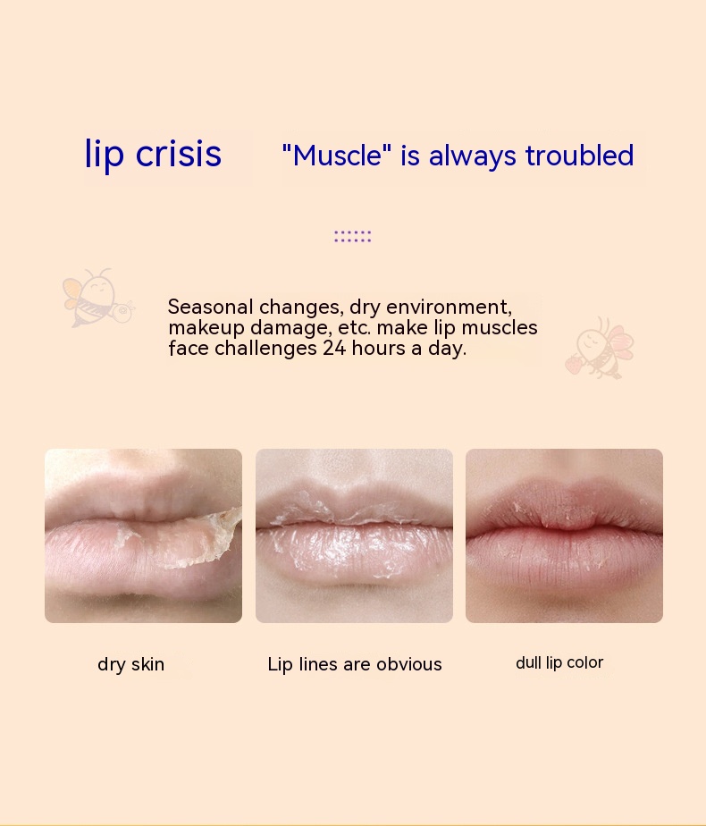 Title 1, Four Sets Of Lip Masks To Improve Lip Dryness, ...