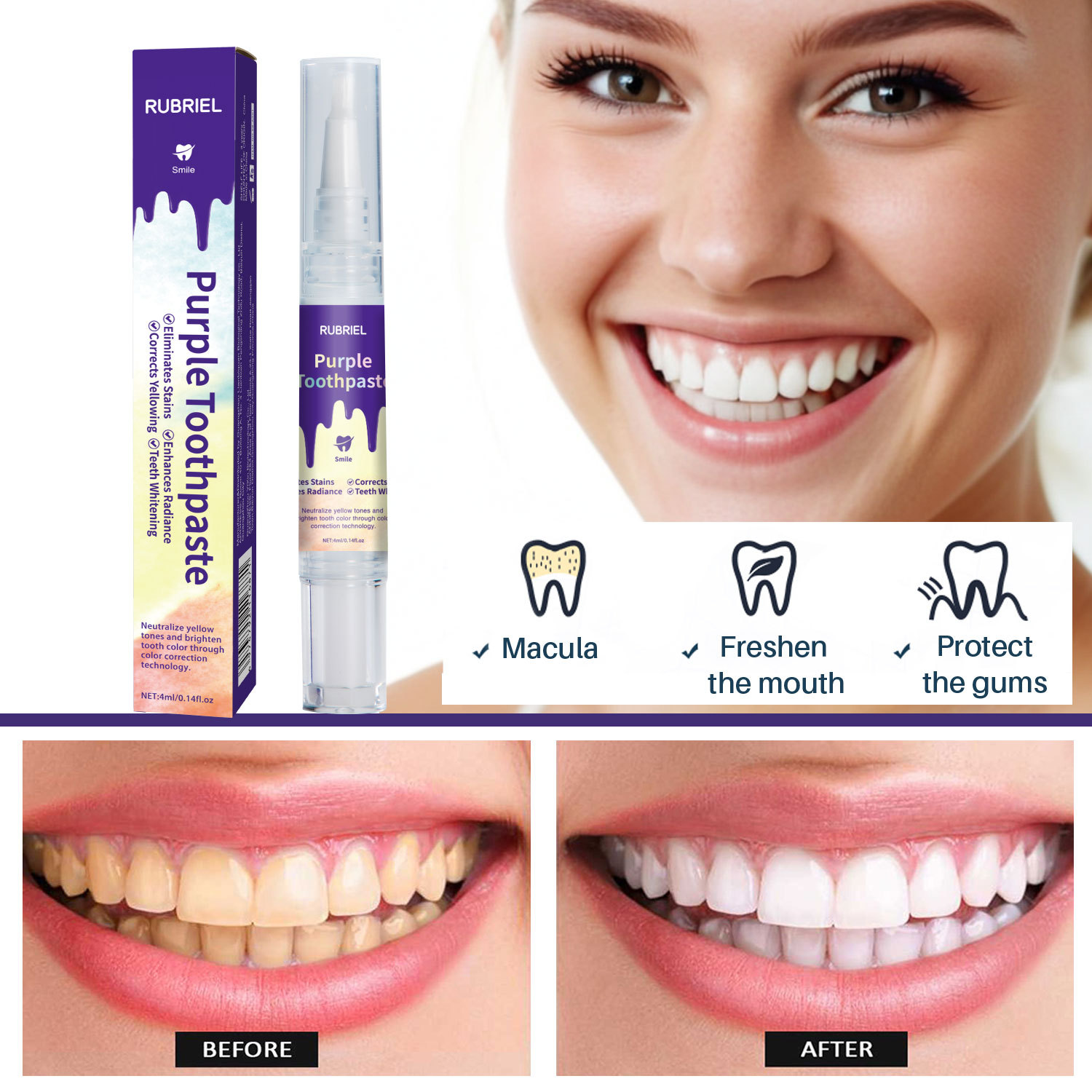 Title 9, Purple Tooth Pen Whitening