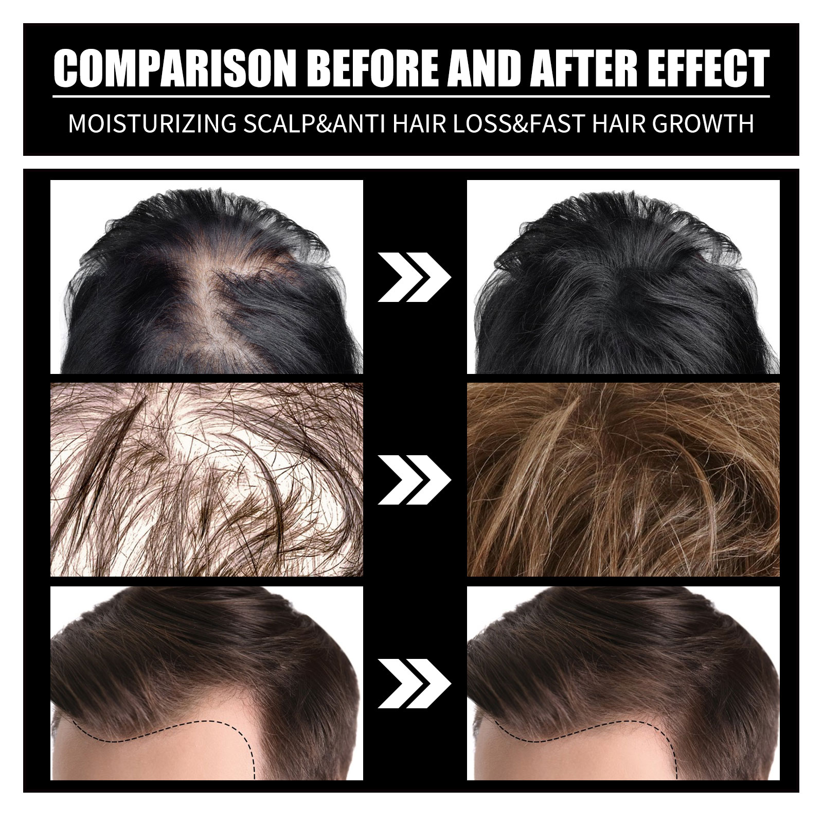 OUHOE Collagen B7 Vitamin Hair Oil Strengthening & Densification Loss Prevention Care