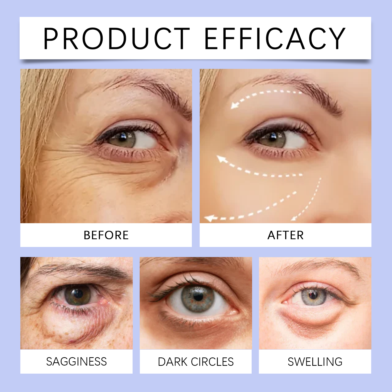 OUHOE collagen eye cream product efficacy graphic showing before-and-after eye area comparisons