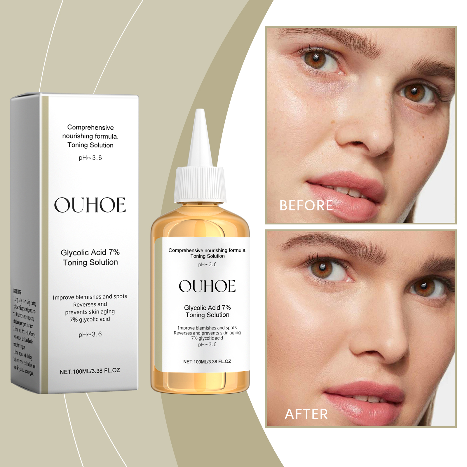 OUHOE Glycolic Acid 7% Moisturizing Toner, Remove Acne, Improve Skin Condition And Rejuvenate Skin Toner Essence image 2