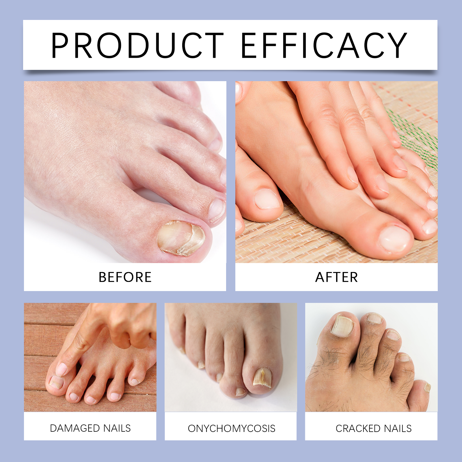 Houkea Bee Venom Nail Repair Lotion Gently Cleanses Nails, Moisturizes And Brightening Nails Soothing Care Essence image 14