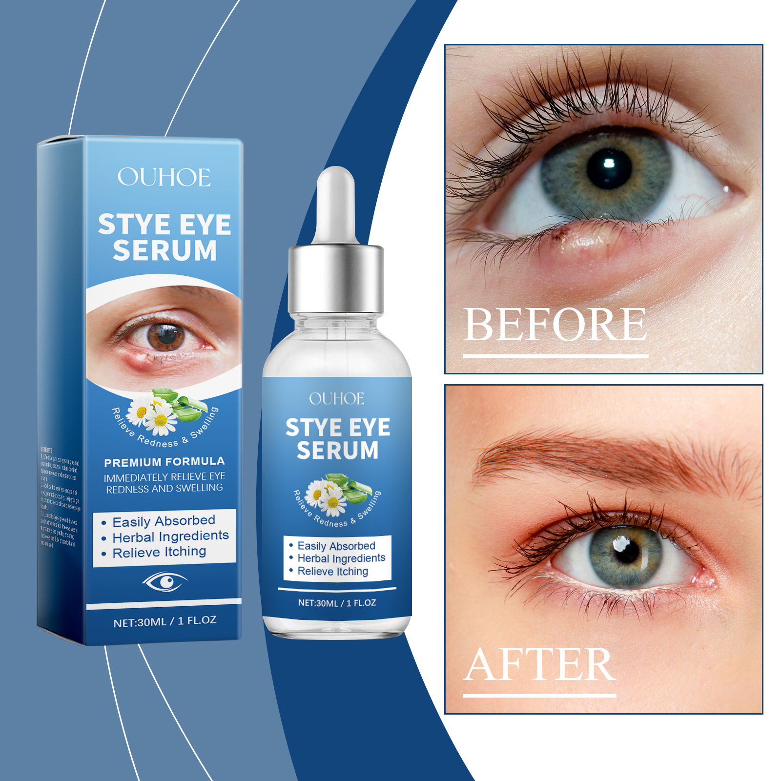 OUHOE Eye Care Drops Gently Nourish And Moisturize The Skin Around The Eyes. Portable Daily Eye Care… image 2