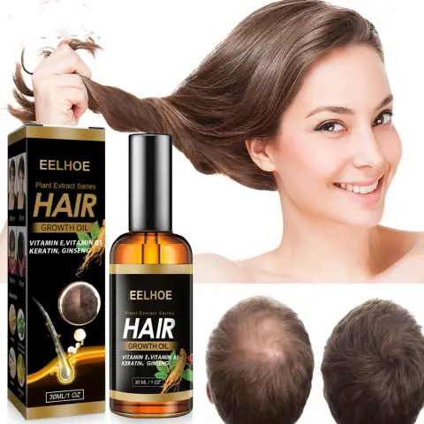 Ginger Repair Hair Follicle Soft Moisturizing and Nourishing Essential