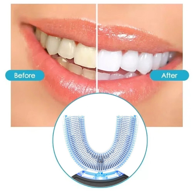 360 U-Shaped Electric Toothbrush With Automatic Blue Light For Adults — image 6