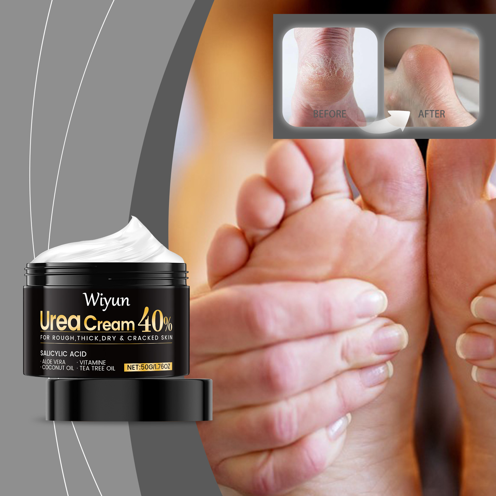 Hand And Foot Care Urea Cream — foto 3