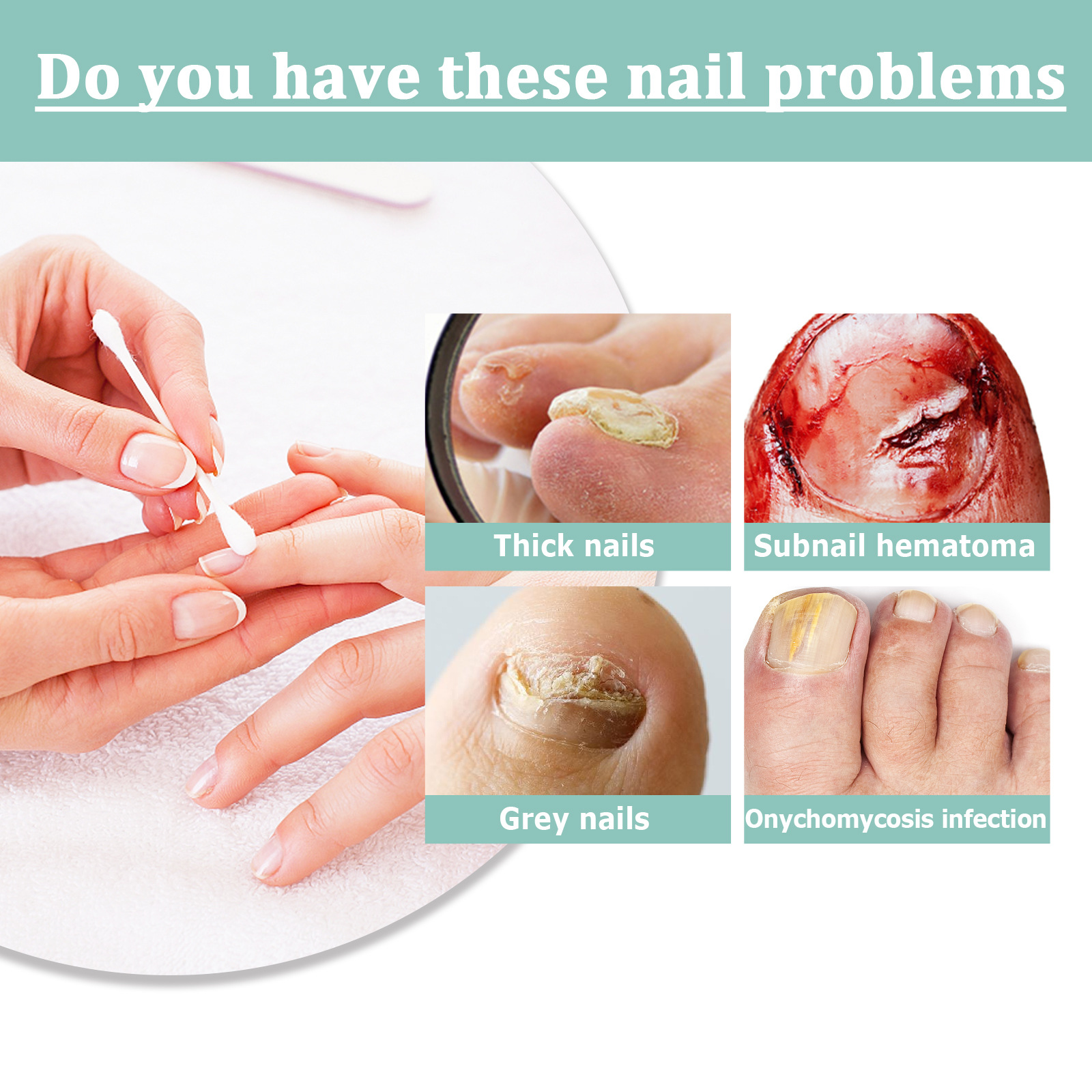 Nail Repair Pen Nail Removal Dead Skin Barbed Moisturizing Repair Pen - Image 16