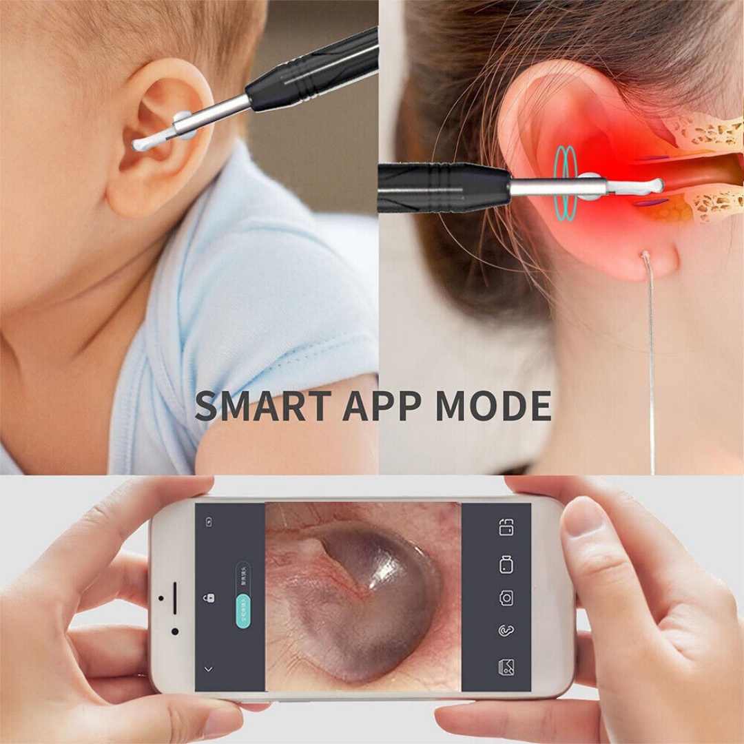 Smart Visual Earpick Ear Wax Removal Cleaner WiFi Ear Stick Endoscope Camera AU-black