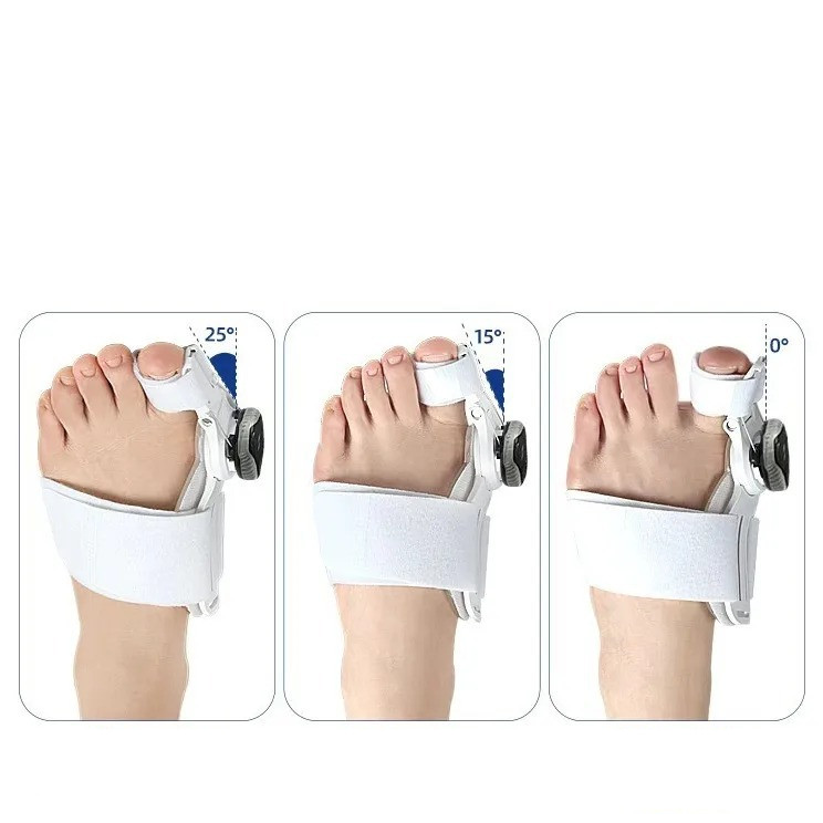 Verstelbare hallux-valguscorrector – wit