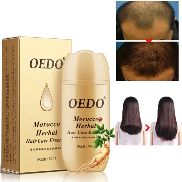 Moroccan Herbal Hair Treatment Serum Q2 Bottles - Shop at LoveMi