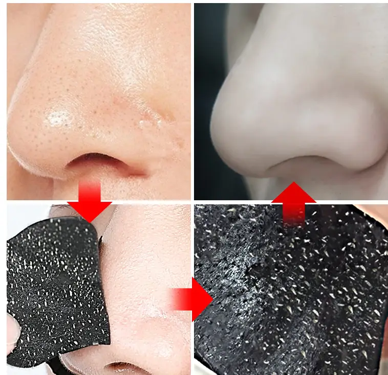 Black nose