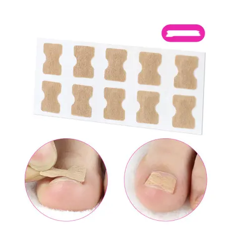 Glue-free Orthopaedic Nail Fixation Device