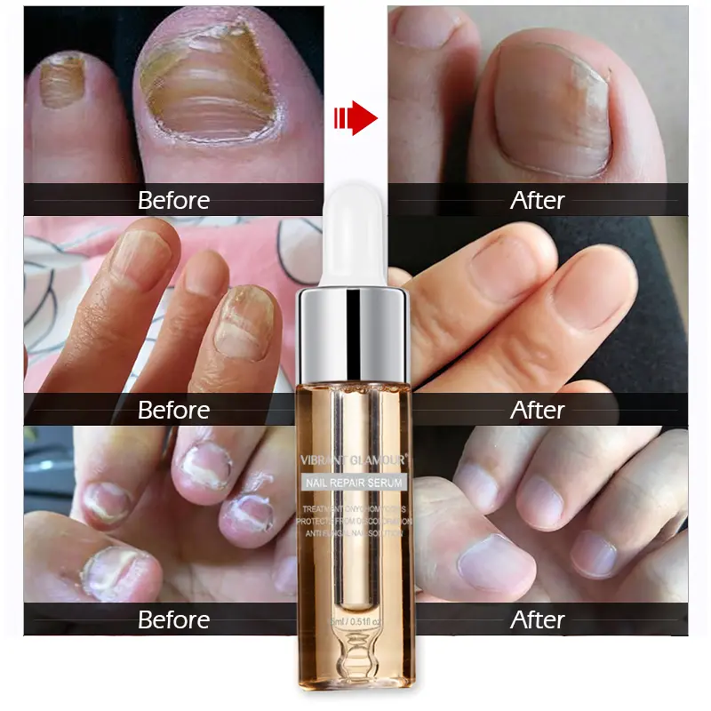 Nail repair and maintenance liquid