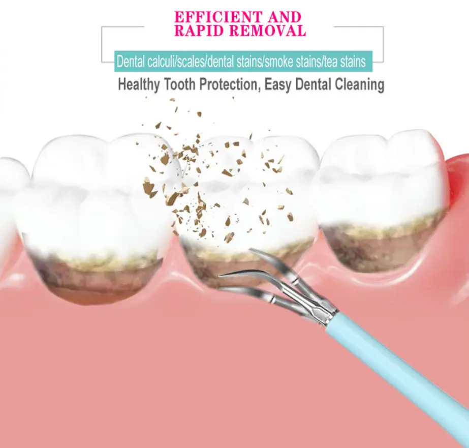 Multifunctional Dental Scaler