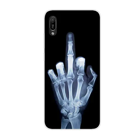Mobile Phone Case Cute Cartoon Painted Anti-fall