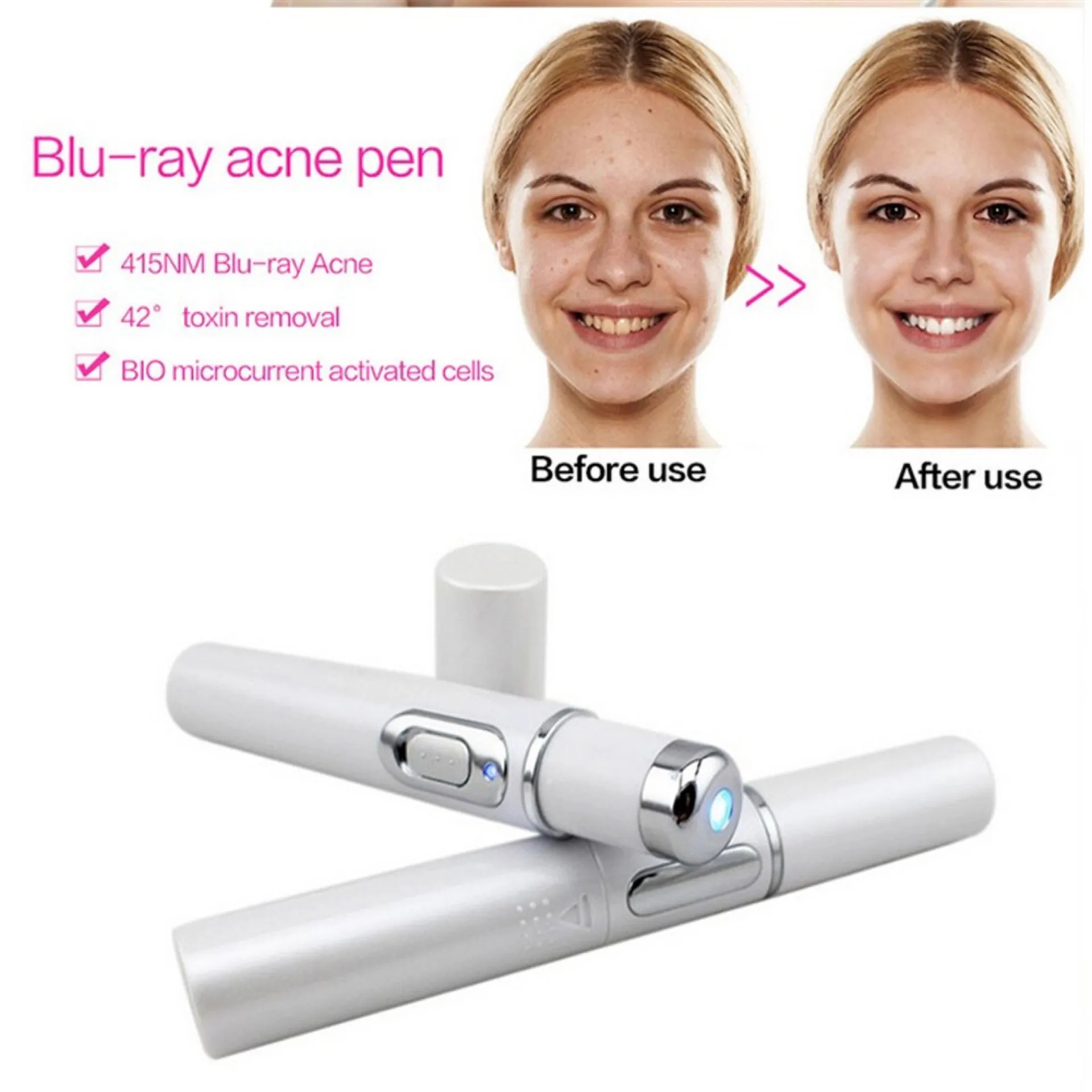 Blue Light Therapy Acne Laser Pen Soft Scar Wrinkle Removal Treatment Device Skin Care Beauty Equipment – image 9