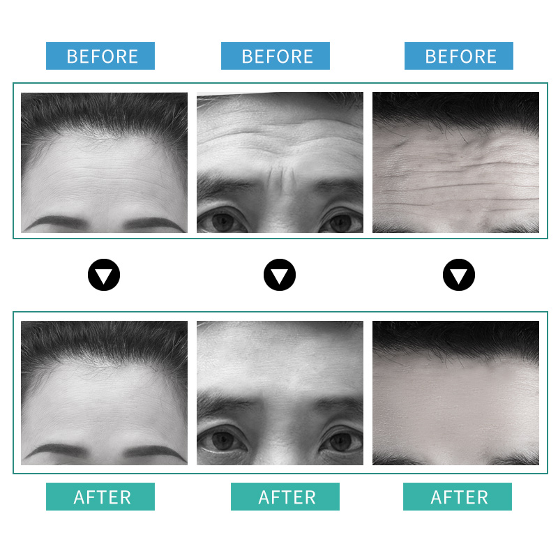 Forehead light pattern paste