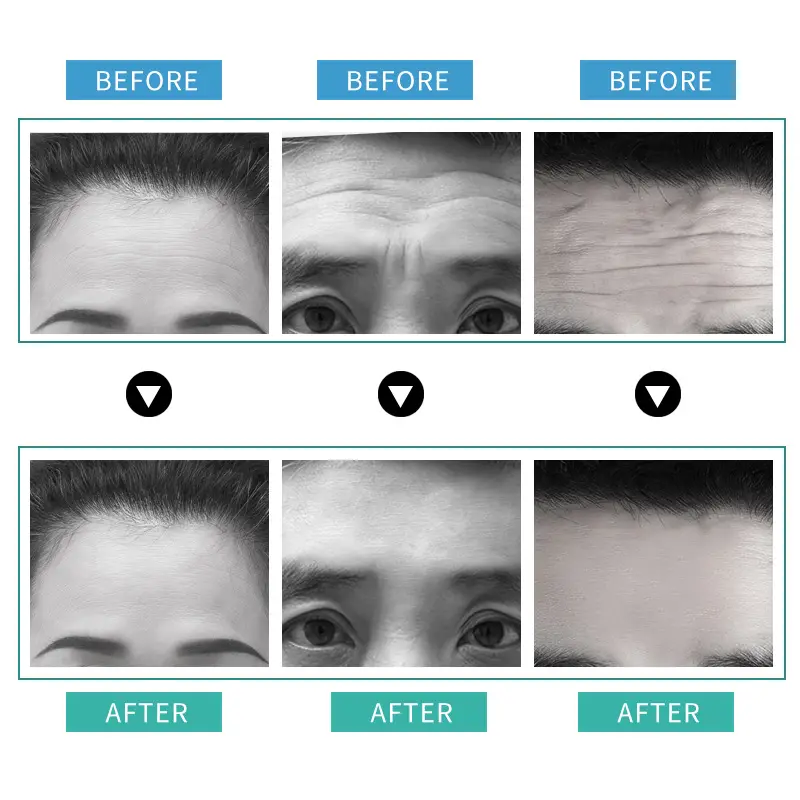 Forehead light pattern paste