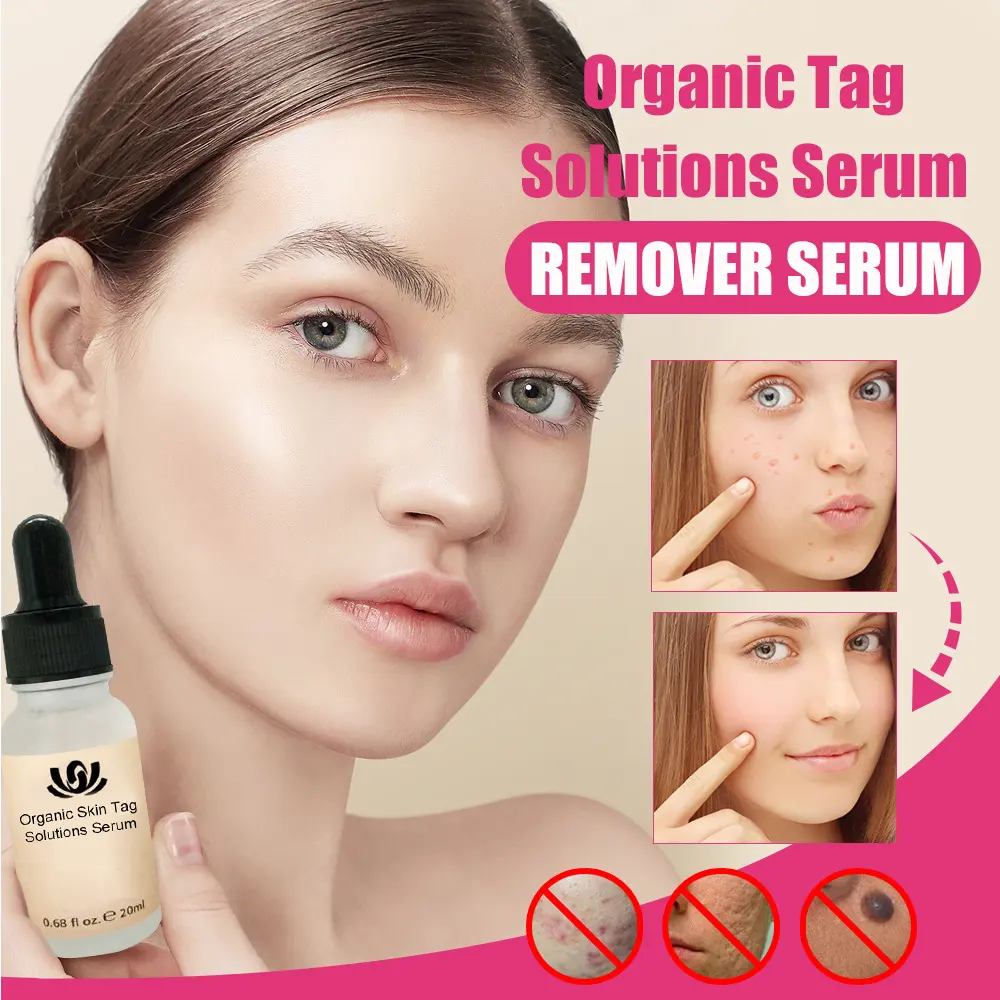 Organic Tags Solutions Serum No Trace Painle Skin Tag
