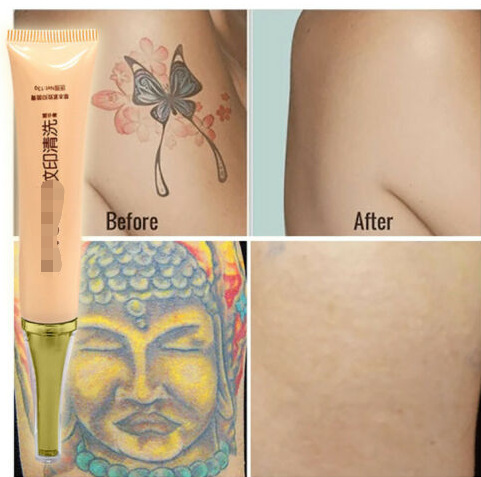 Tattoo Removal Cream