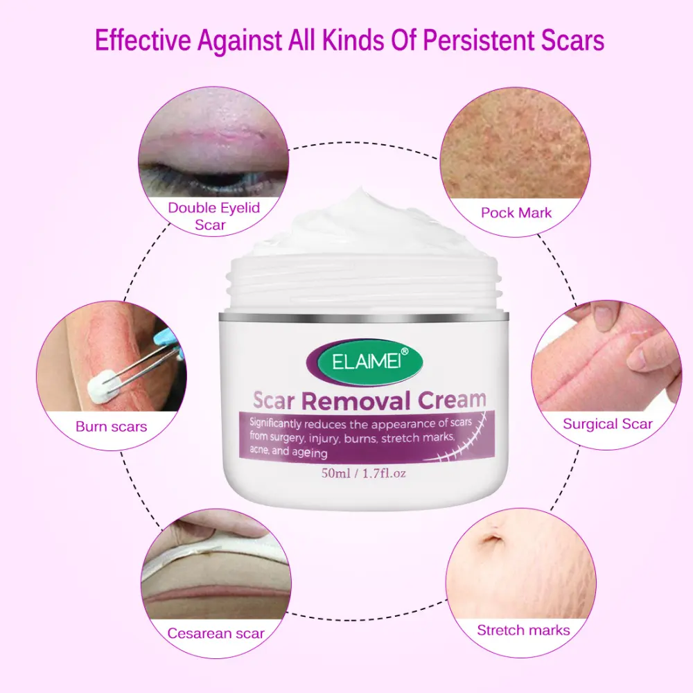 Skin Rebound Scarless Cream Scar Removal Face for Acne