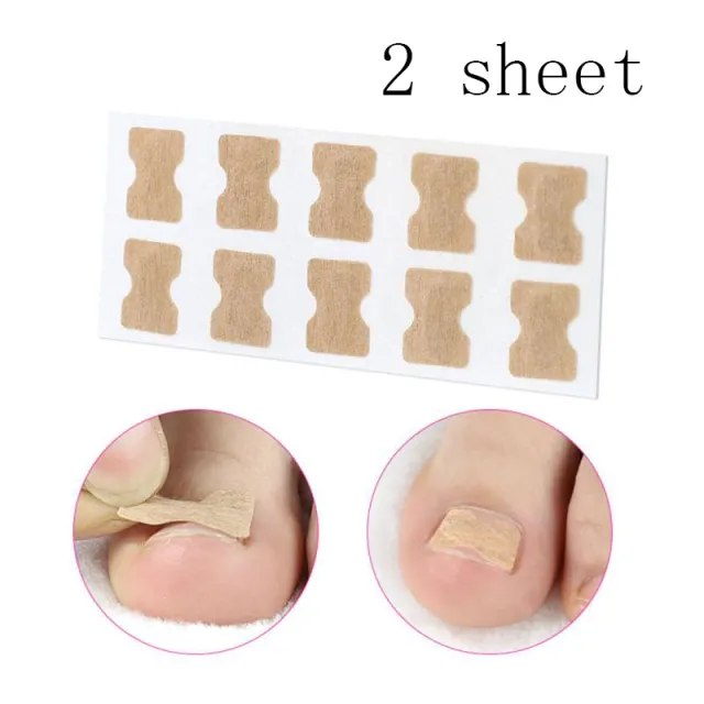 Glue free orthopaedic nail fixation device Beige - Shop at LoveMi
